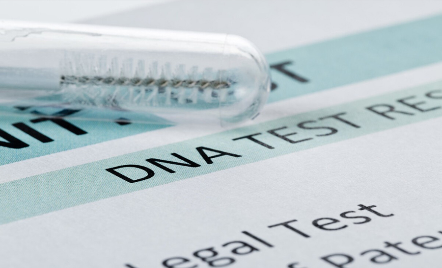 山东省医院做DNA鉴定生物样本有哪几种,山东省医院做血缘检测准确吗